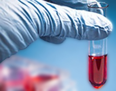 進(jìn)口血清 胎牛血清